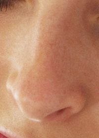 Korekta nosa